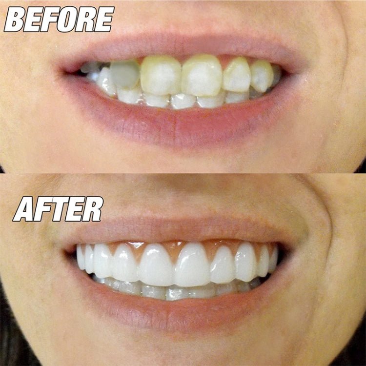 Beauty Tool False Teeth Instant Smile Comfort Fit Flex Fake Tooth Cover BEI WRH - Mega Discount Store LebanonLebanon